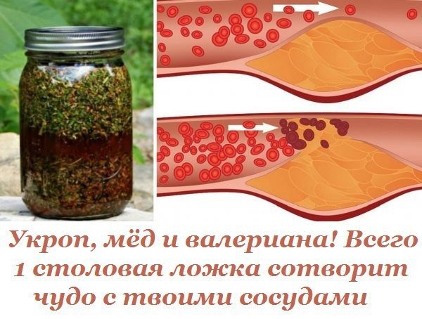 Укроп, мёд и валериана! Всего 1 столовая ложка сотворит чудо с твоими сосудами. 