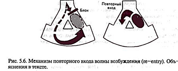 Нарушения ритма сердца 