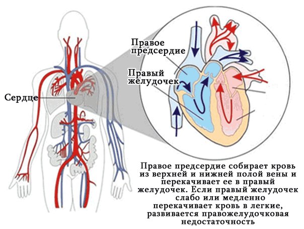 Причины правожелудочковой недостаточности