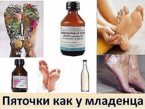 Пяточки как у младенца 