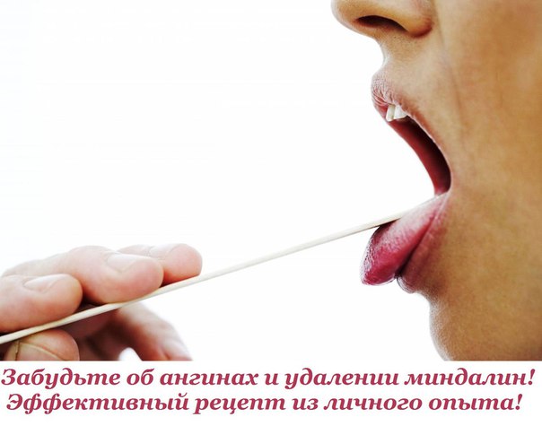 Забудьте об ангинах и удалении миндалин! Эффективный рецепт из личного опыта! 