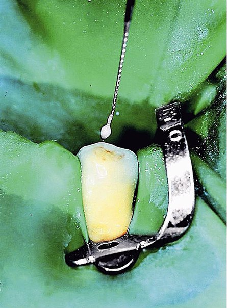 #статьи_alldental