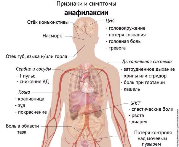 Симптомы заболеваний в картинках.