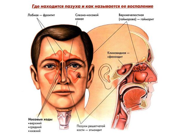 Острый катаральный насморк всегда возникает внезапно. При травмах он может ограничиваться одной стороной. Простудные и симптоматические насморки всегда двусторонни. Довольно большое число авторов различает три периода насморка, или стадии, в течении острого катарального насморка.