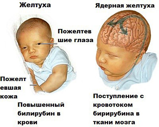 Билирубин — основной желчный пигмент человека, имеющий красно-желтый цвет. Является продуктом распада гемоглобина и других белков крови, таких как цитохромы, каталаза, пероксидаза и миоглобин. Процесс распада осуществляется специальными клетками, так называемыми ретикулоэндотелиальными клетками, которые располагаются в основном в печени, селезенке и костном мозге. Примерно 85% билирубина образуется из гемоглобина эритроцитов. Из одного грамма гемоглобина образуется около 35 мг билирубина. Из организма билирубин выводиться с желчью. Именно билирубин окрашивает синяки в желтый цвет. При определенных заболеваниях уровнь билирубина в крови повышается. Некоторые растения также содержат билирубин. 
