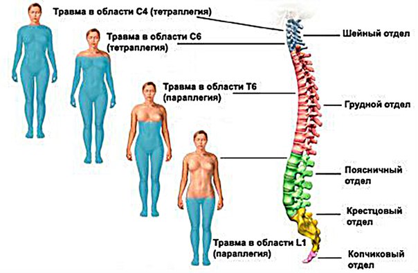 Симптомокомплексы поражения спинного мозга на различных его уровнях 