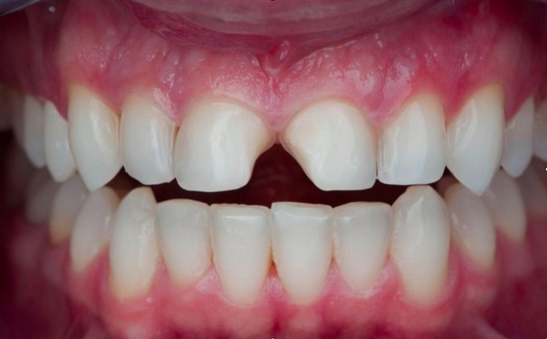 #статьи_alldental