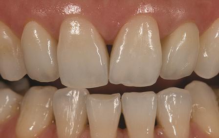 #статьи_alldental