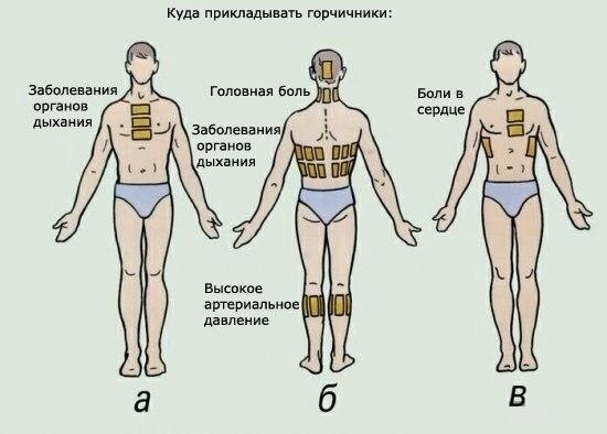 КАК ПРАВИЛЬНО СТАВИТЬ ГОРЧИЧНИКИ 