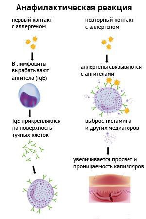 Анафилактический шок 