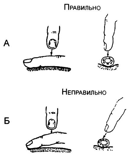 Сравнительная и топографическая перкуссия 