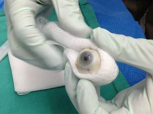 Пересаживать глаза людям начнут в течение ближайших десяти лет