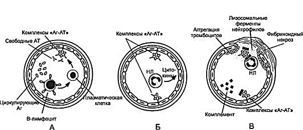 Аллергические реакции типа IV 