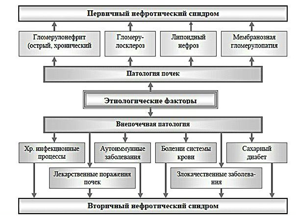Нефротический синдром 