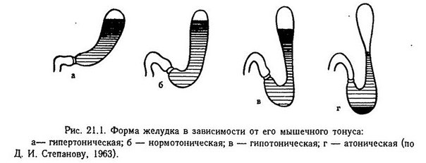 Нарушение двигательной функции желудка 