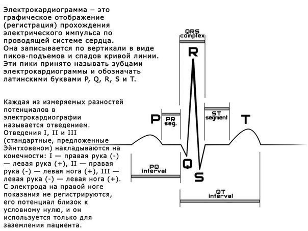 Отличная шпаргалка по ЭКГ! 