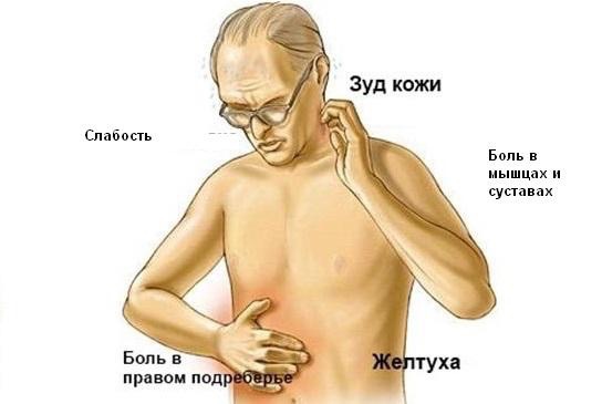 Триада Шарко (наблюдается при остром холангите): 