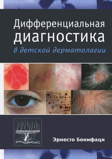  Дифференциальная диагностика в детской дерматологии 
