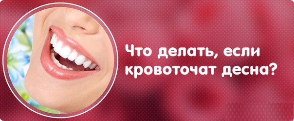 ЕСЛИ КРОВОТОЧАТ ДЕСНА 