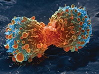 Лечение и диагностику рака переворачивает новый материал