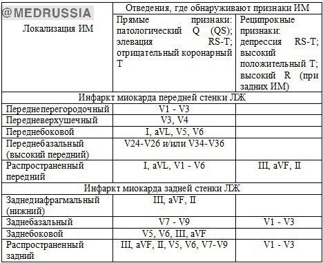 Локализация инфаркта миокарда