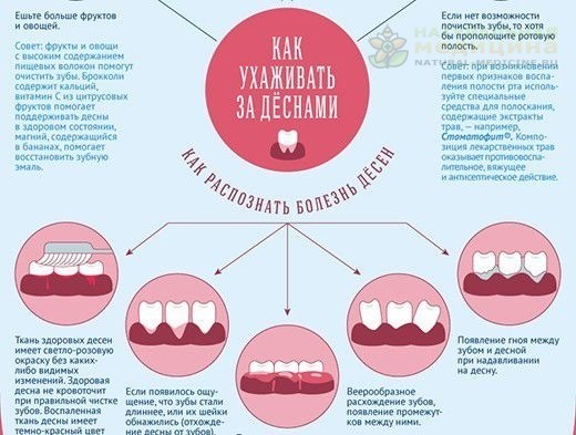  Ещё больше рецептов, статей и советов на нашем сайте    заходите