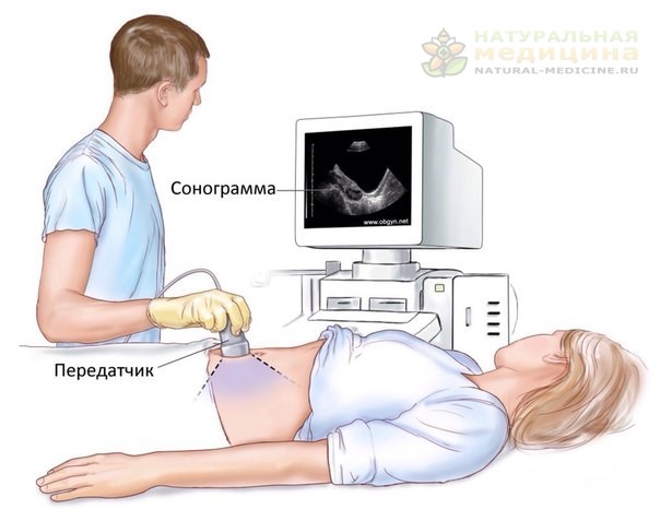 УЗИ 