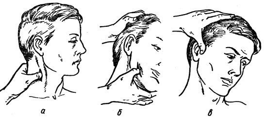 Точки прижатия артерий головы для остановки кровотечения