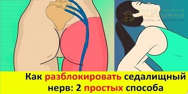 Как разблокировать сeдалищный нeрв: 2 простыx способа снять боль. 