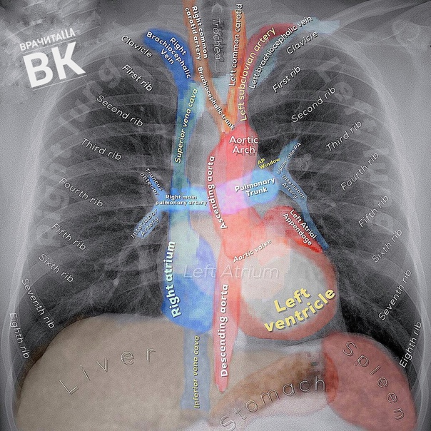 Обязательно сохранить себе на стену и просмотреть в свободную минутку. Меня (я не лучевой диагност) этот пост обучил больше, чем весь цикл по Лучам) Кто не понимает слов на снимках, прошу прощения, но там азы) 