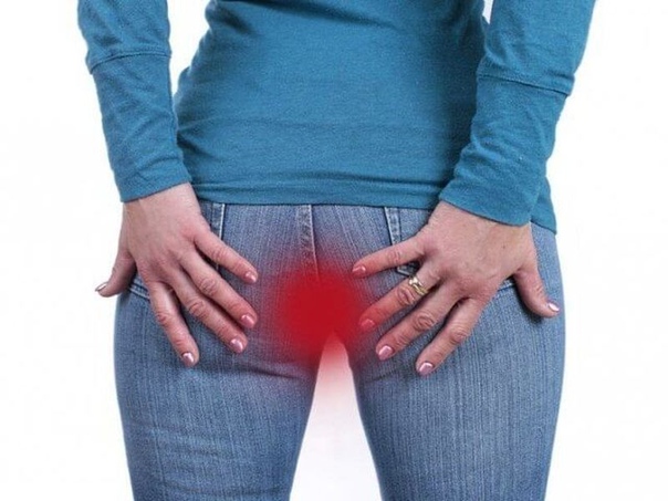 Зуд заднего прохода  