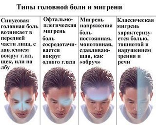 Мигрень – это хроническое неврологическое заболевание, основным проявлением которого являются периодически повторяющиеся приступы интенсивной головной боли, обычно локализующейся в одной половине головы и длящиеся от нескольких часов до нескольких суток. 