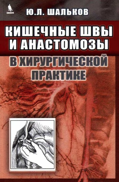 Кишечные швы и анастомозы в хирургической практике. 