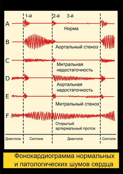 Рекомендации Европейского общества кардиологов (ESC):
